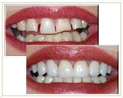 Slider image (8) Bangkok Dental Image